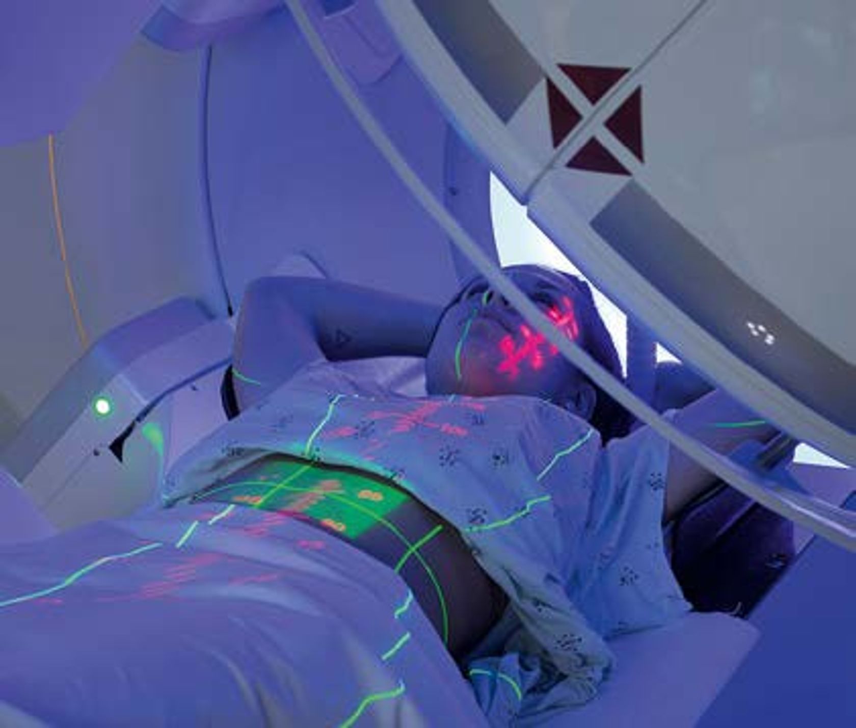 Eine Frau liegt in einem Radiotherapie-Gerät.