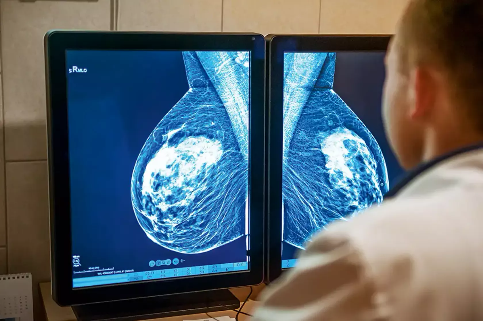 Arzt begutachtet am Monitor Mammographie-Aufnahmen.