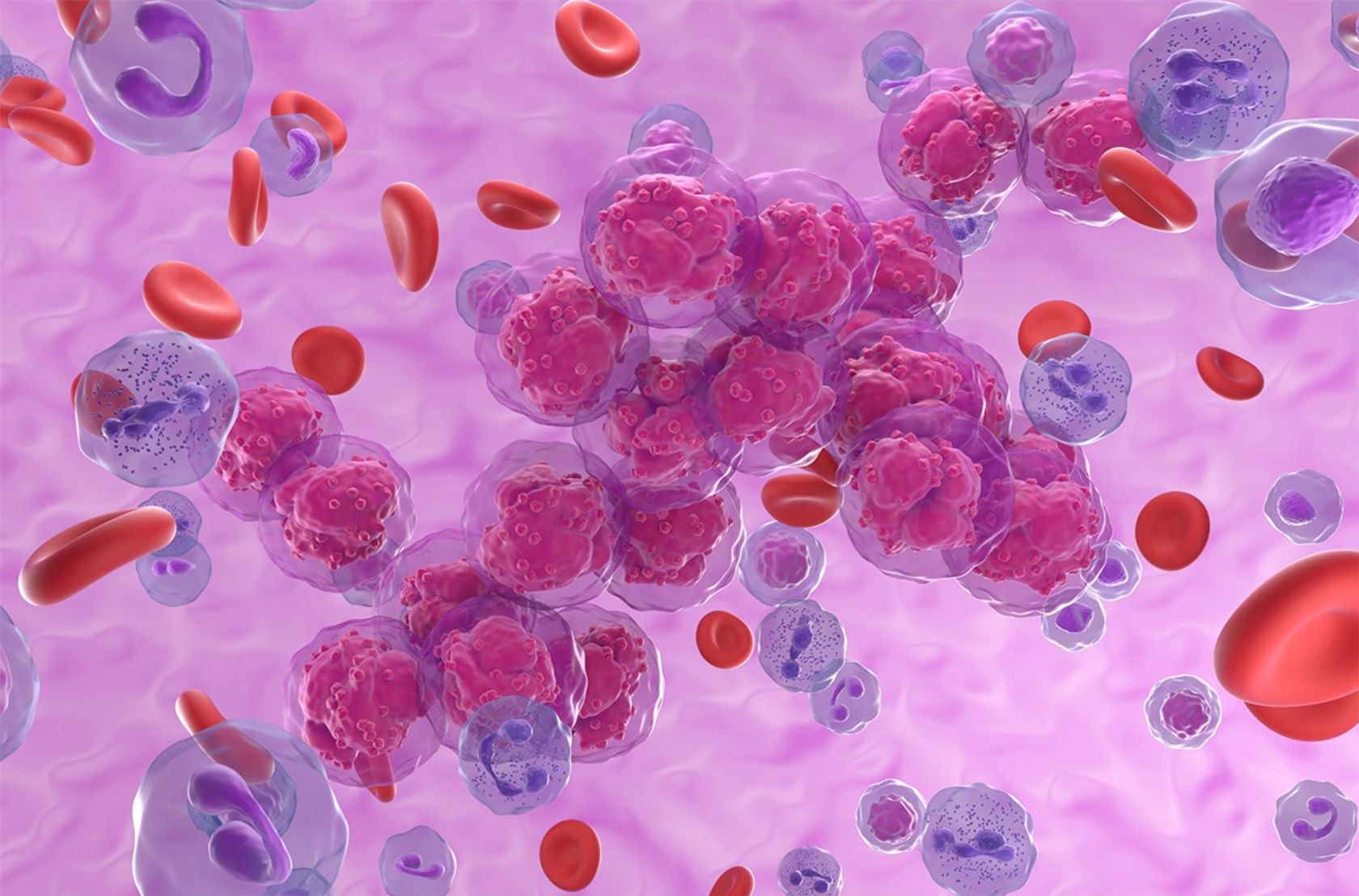 Leukämie-Zellen unter dem REM